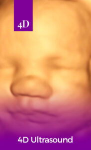 Hello Baby 4D Ultrasound Studio
