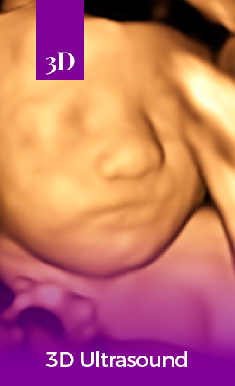 Gallery – Hello Baby 4D Ultrasound Studio